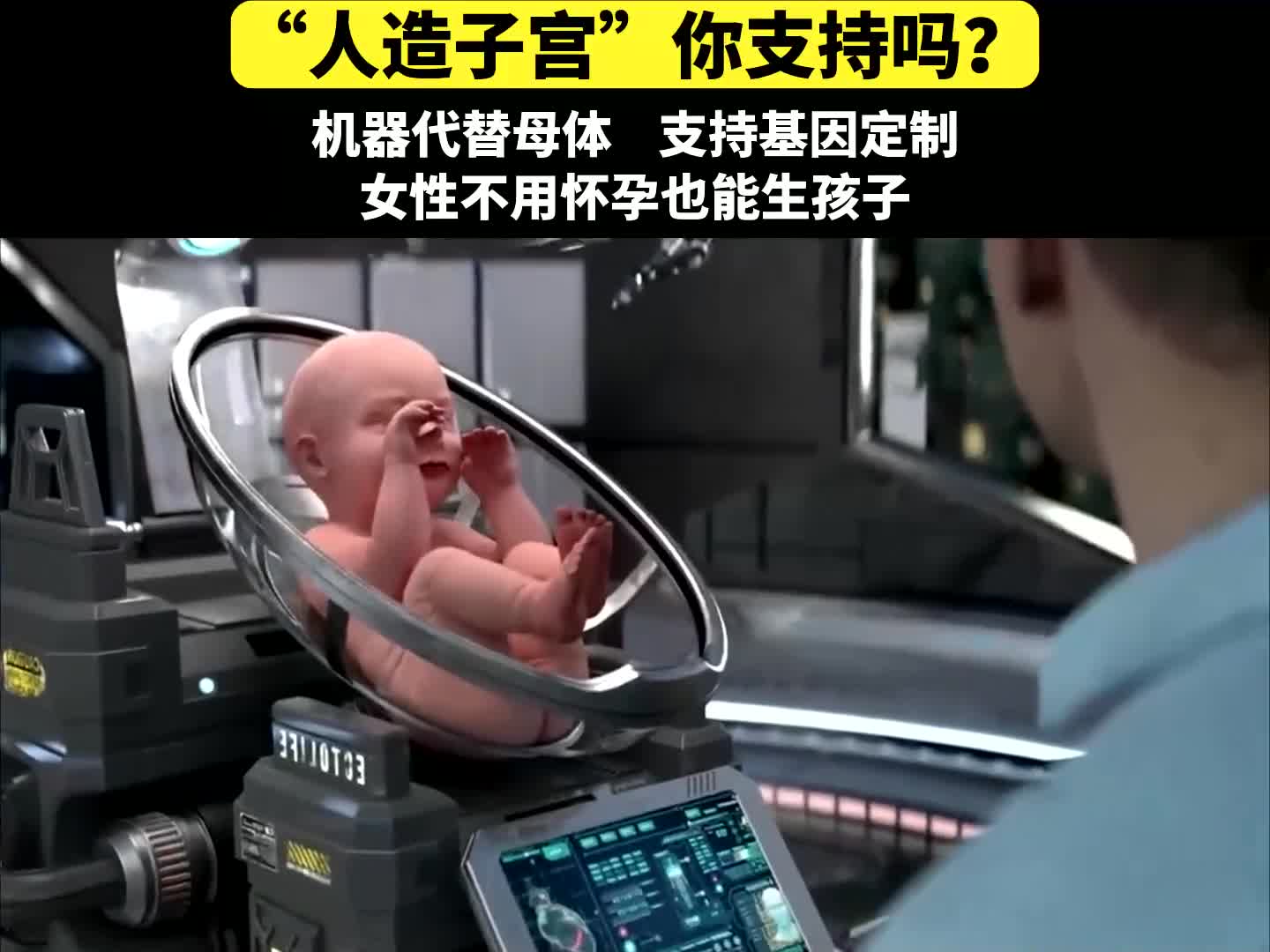 子宫机器生孩子图片