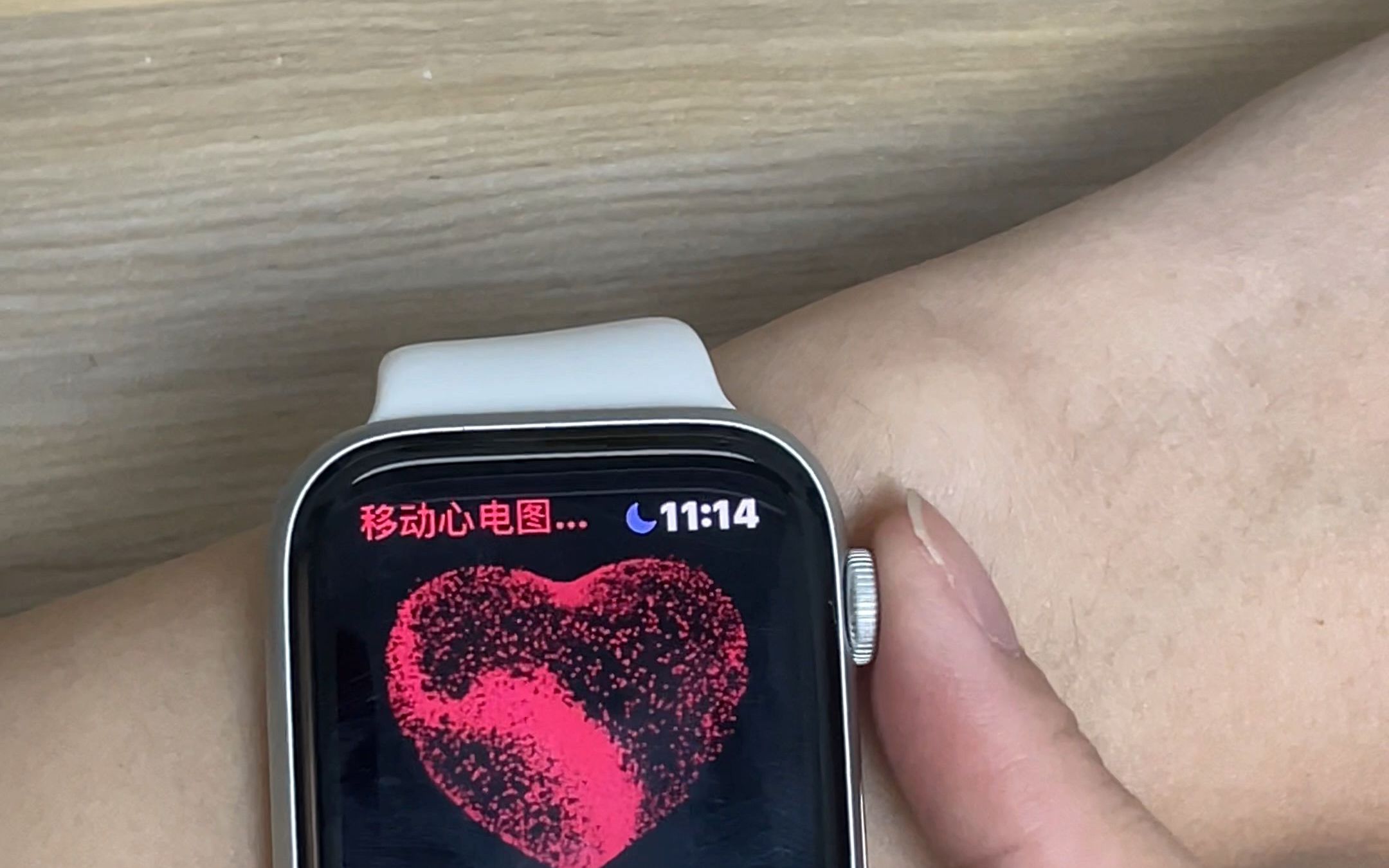 想不到apple watch是国际二级医疗器械哔哩哔哩bilibili