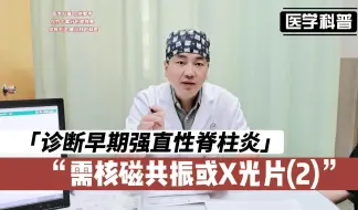 Download Video: 诊断早期强直性脊柱炎一般需要什么呢？需要核磁共振或X光片(2)