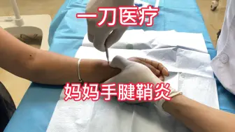 Download Video: 怎么治疗妈妈手（桡骨茎突腱鞘炎）？魏久驰医生