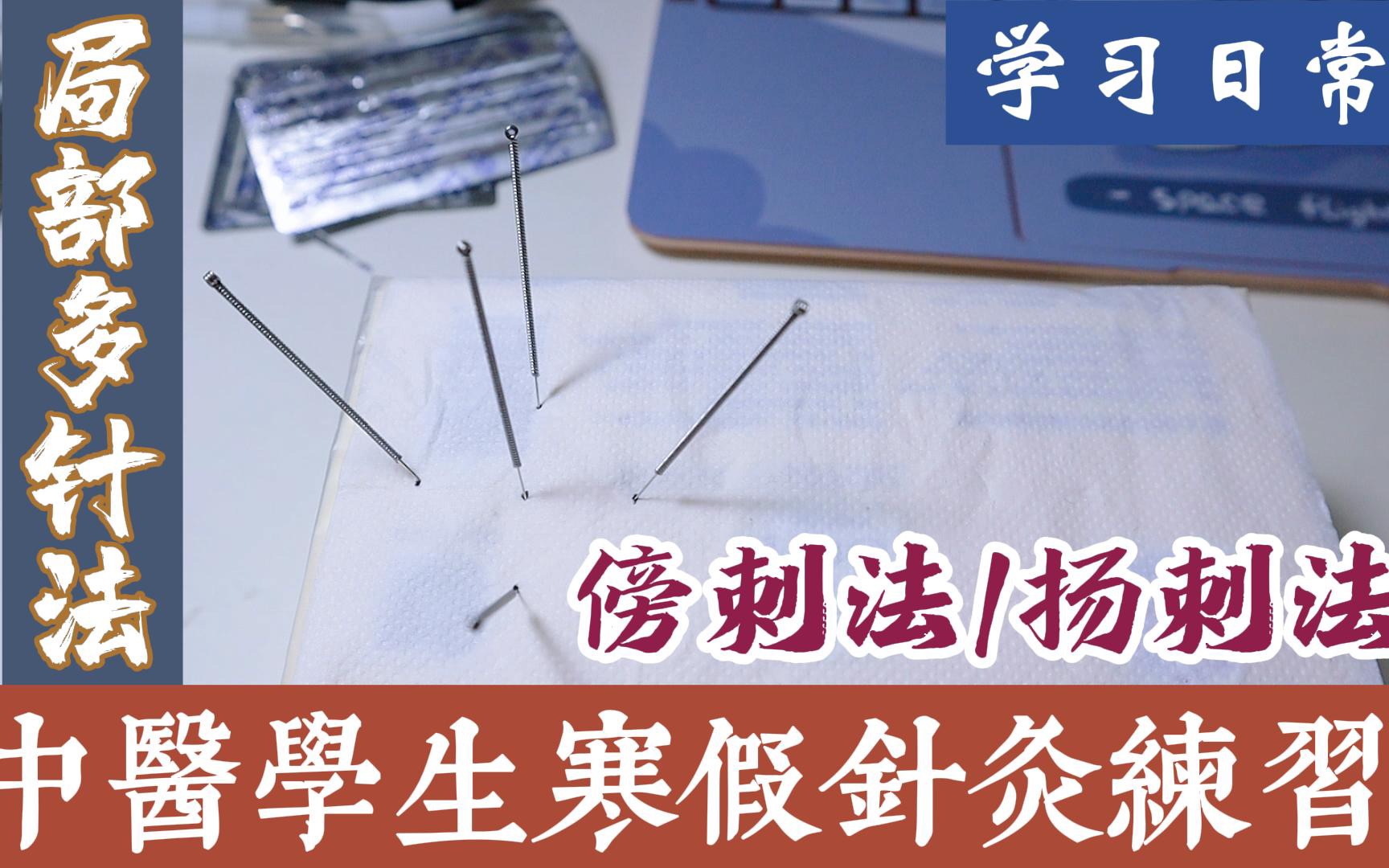 中医学生寒假针灸练习【局部多针法:傍刺法、扬刺法】哔哩哔哩bilibili