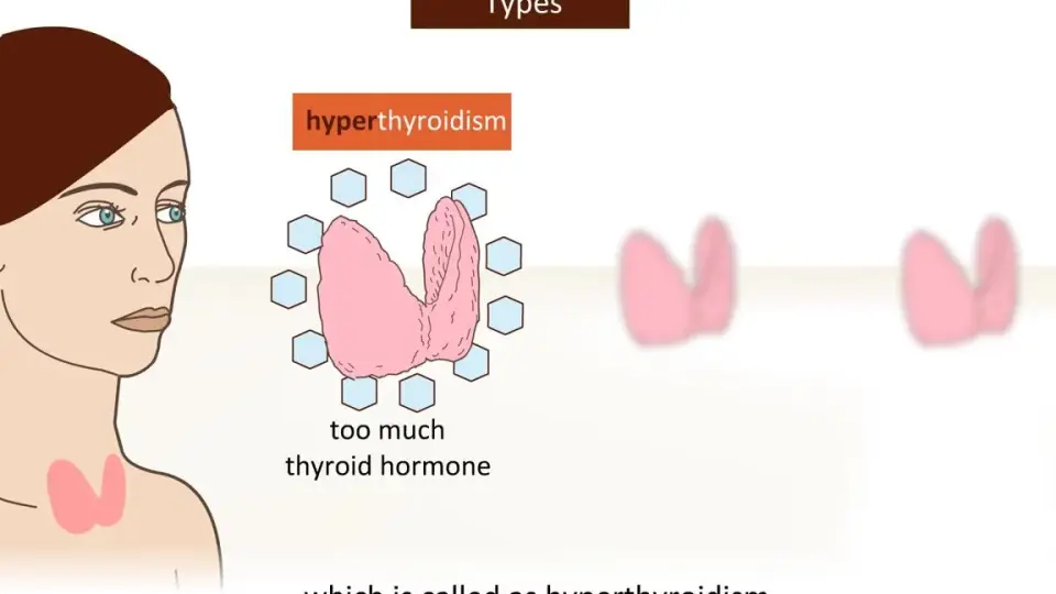 Infectious Mononucleosis (Mono) Signs & Symptoms 