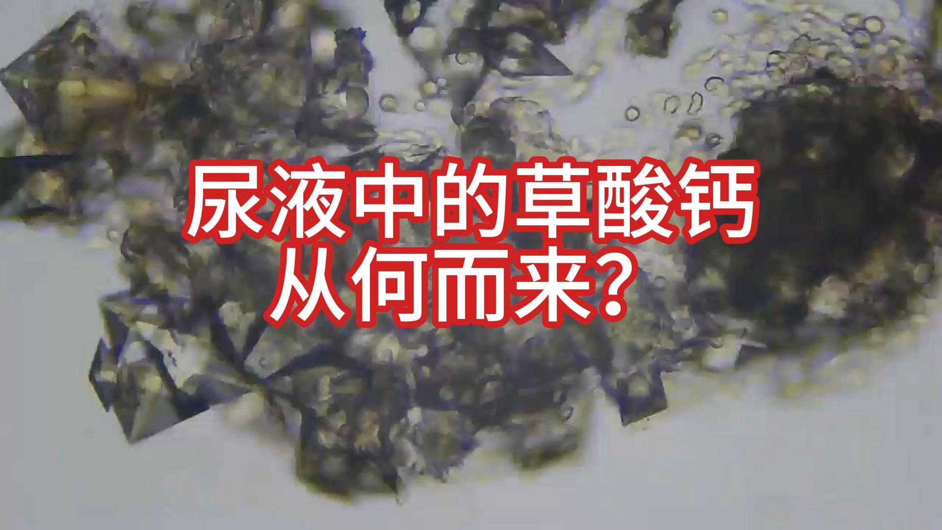 尿液中的草酸钙从何而来?哔哩哔哩bilibili