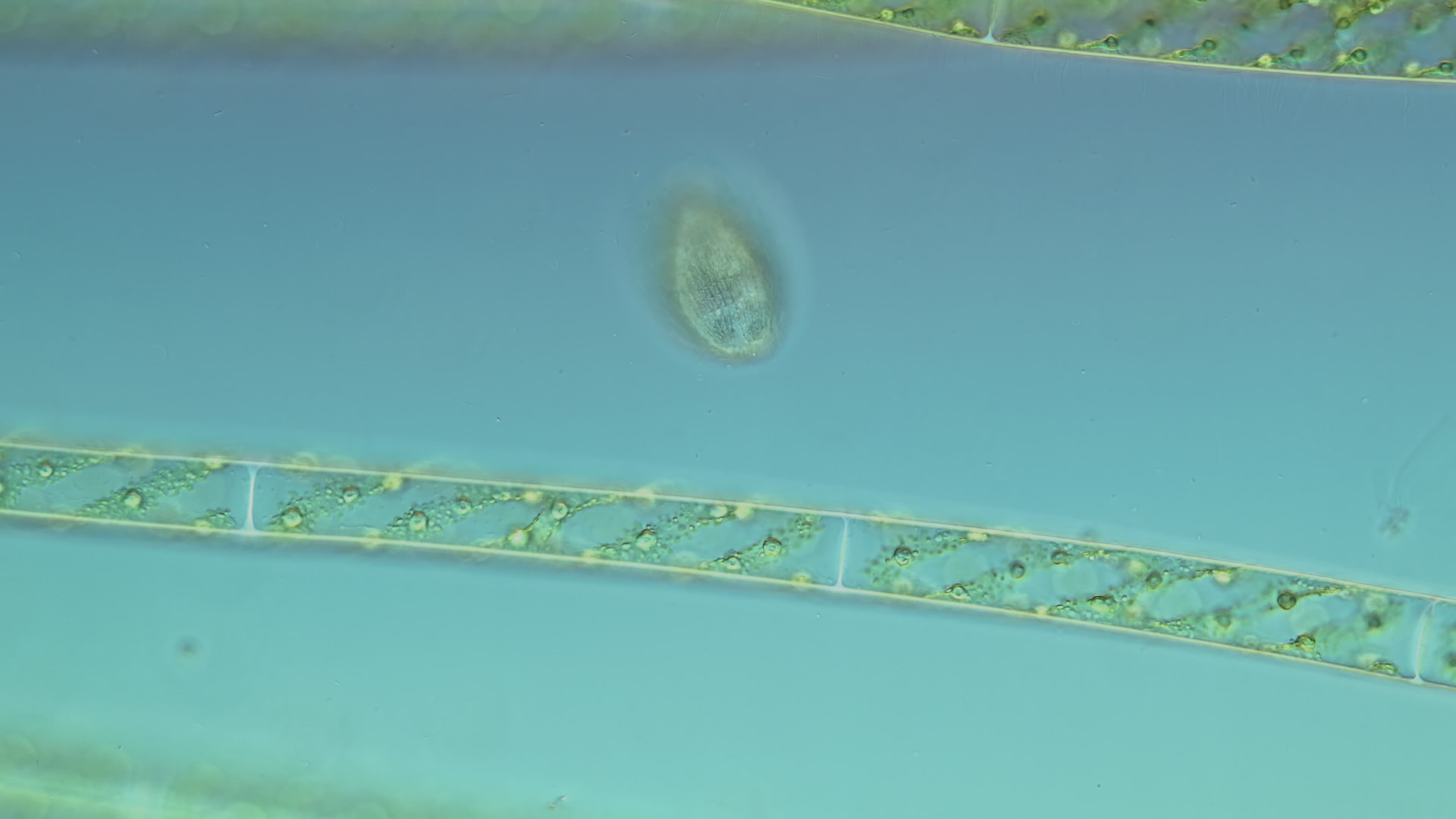 淡水微生物裸口虫