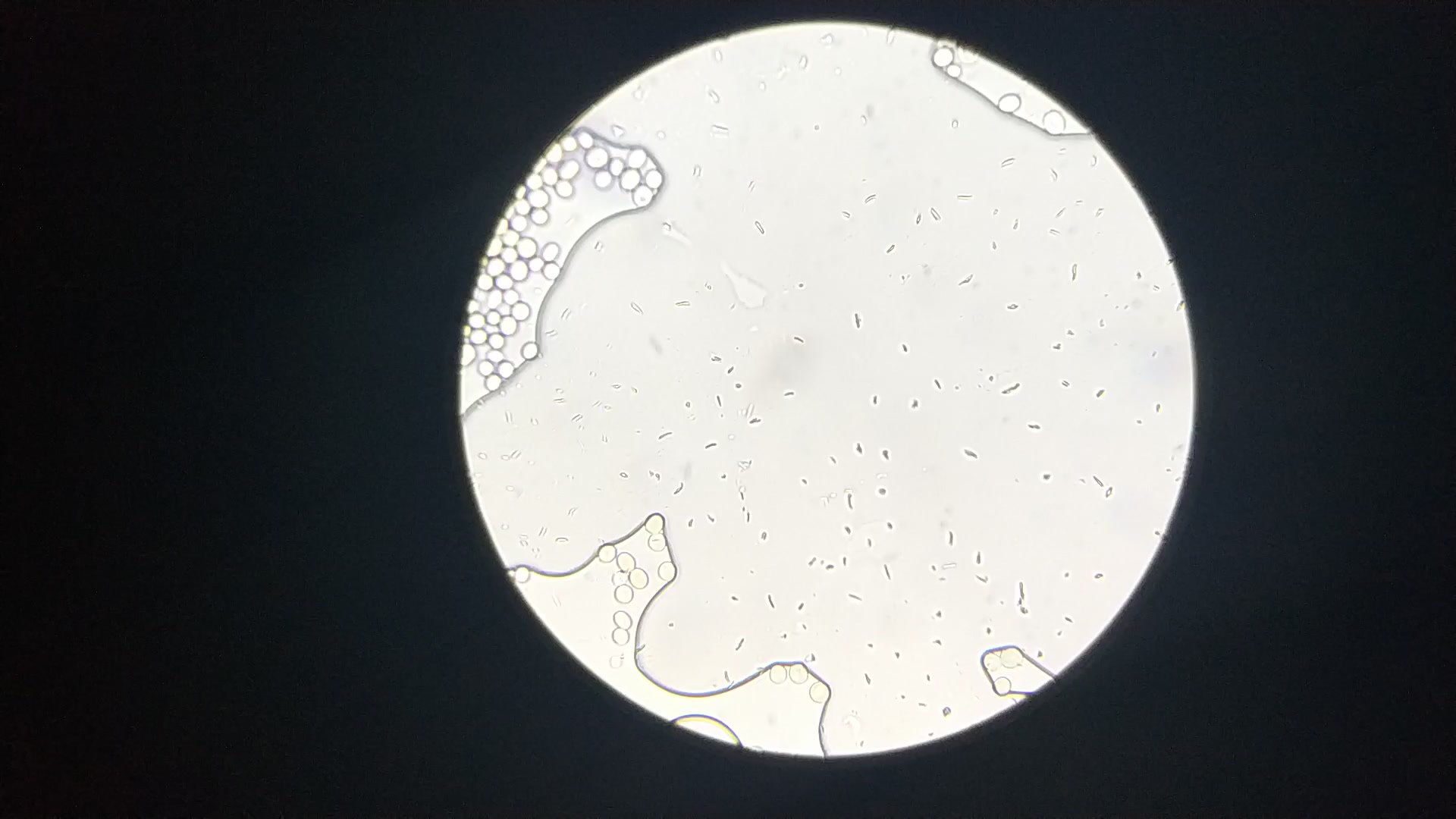 显微镜下的孢子