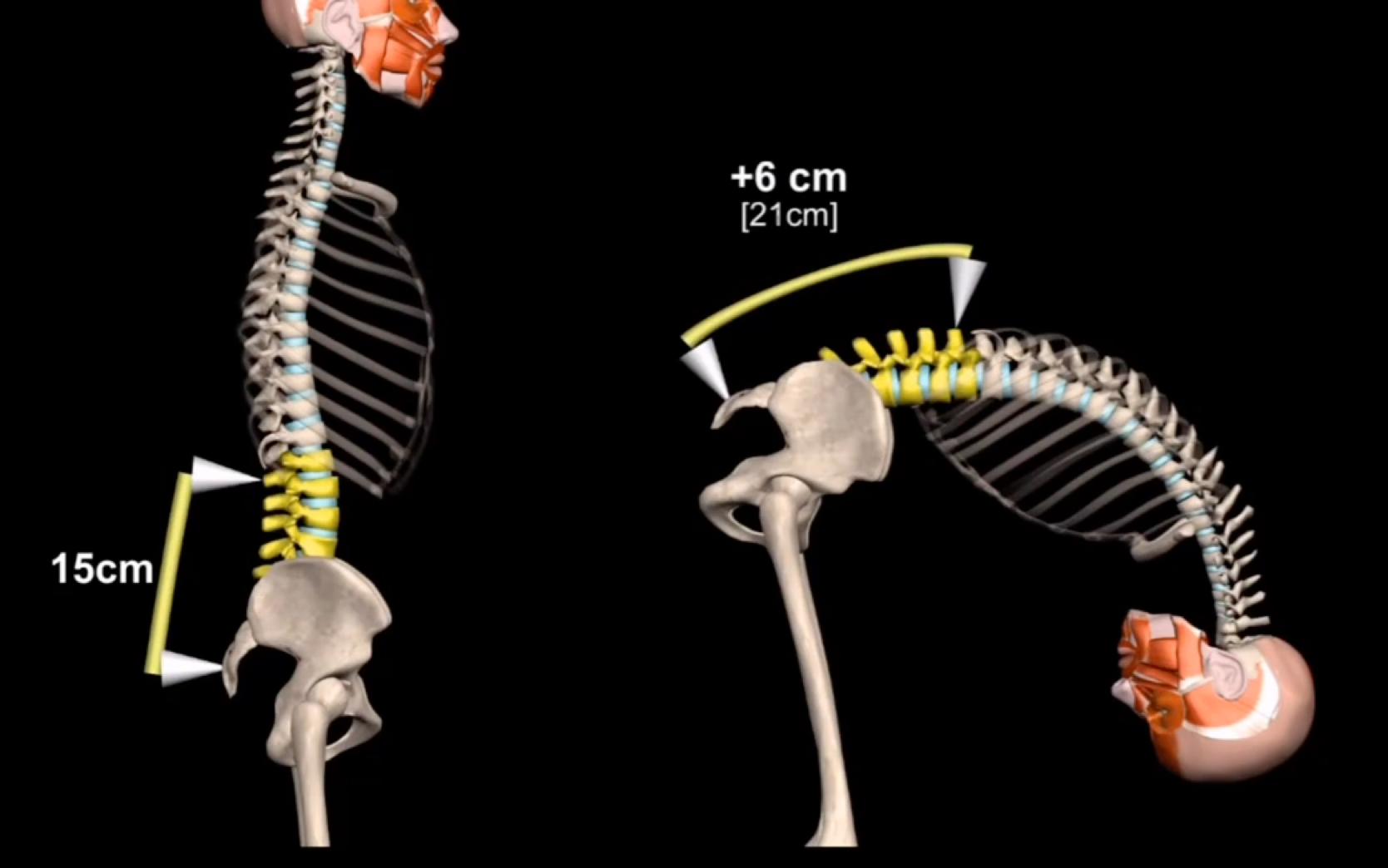 【体态评估】平背姿态评估