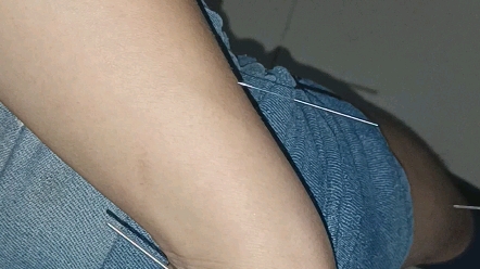 太渊,偏历,足三里,下针_哔哩哔哩_bilibili