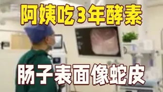 吓人！阿姨吃3年酵素肠子表面宛若蛇皮