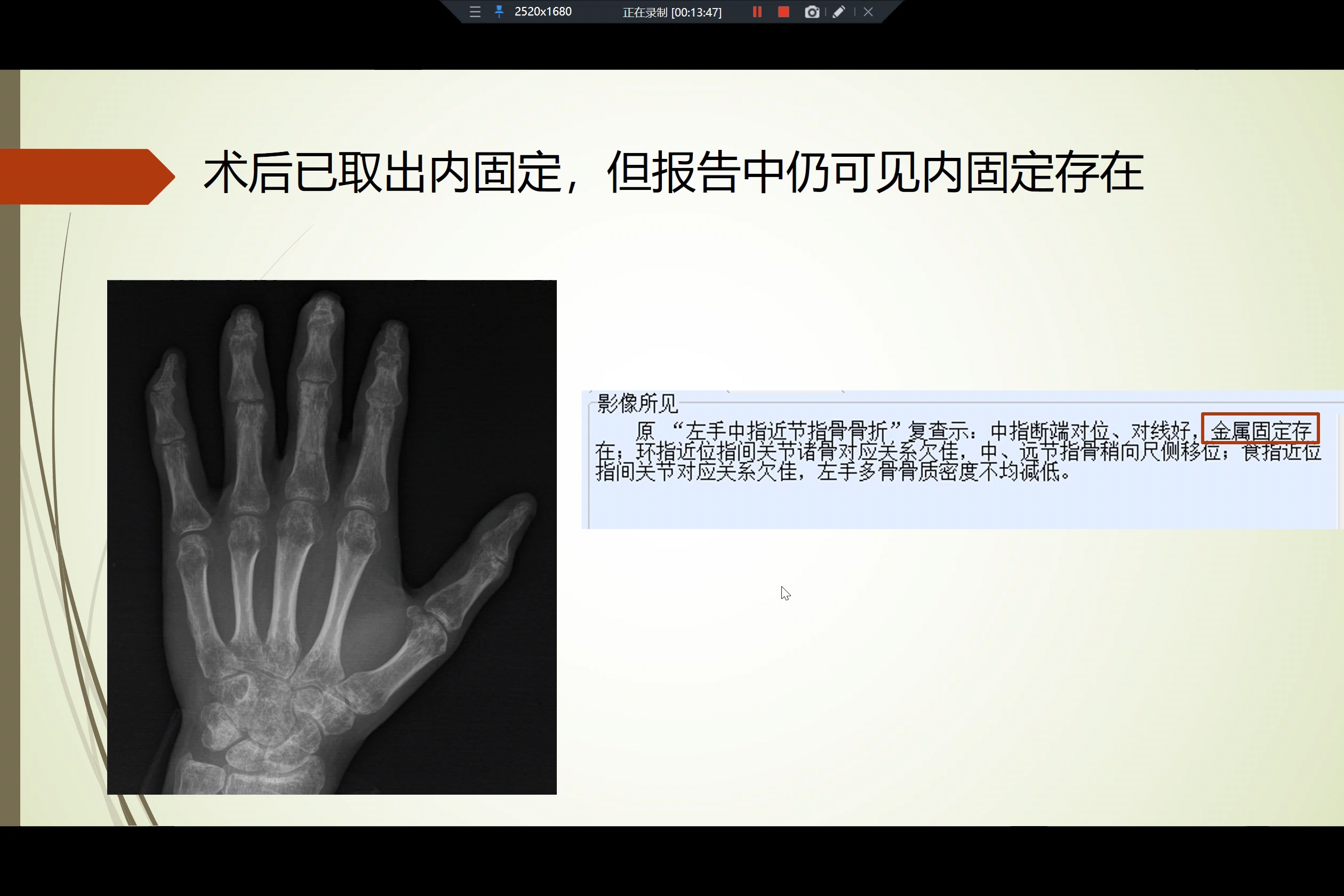 审核报告遇到的问题及应对策略.补档视频@,将来会做成一个视频集.哔哩哔哩bilibili