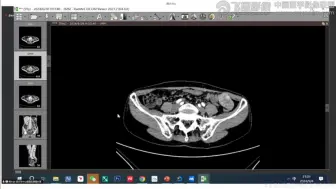 下载视频: 腹部病例分析