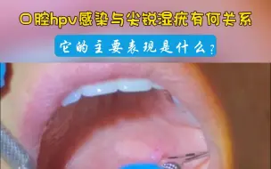 Download Video: 强大的免疫力，可能是你对抗尖锐湿疣的最佳伙伴！