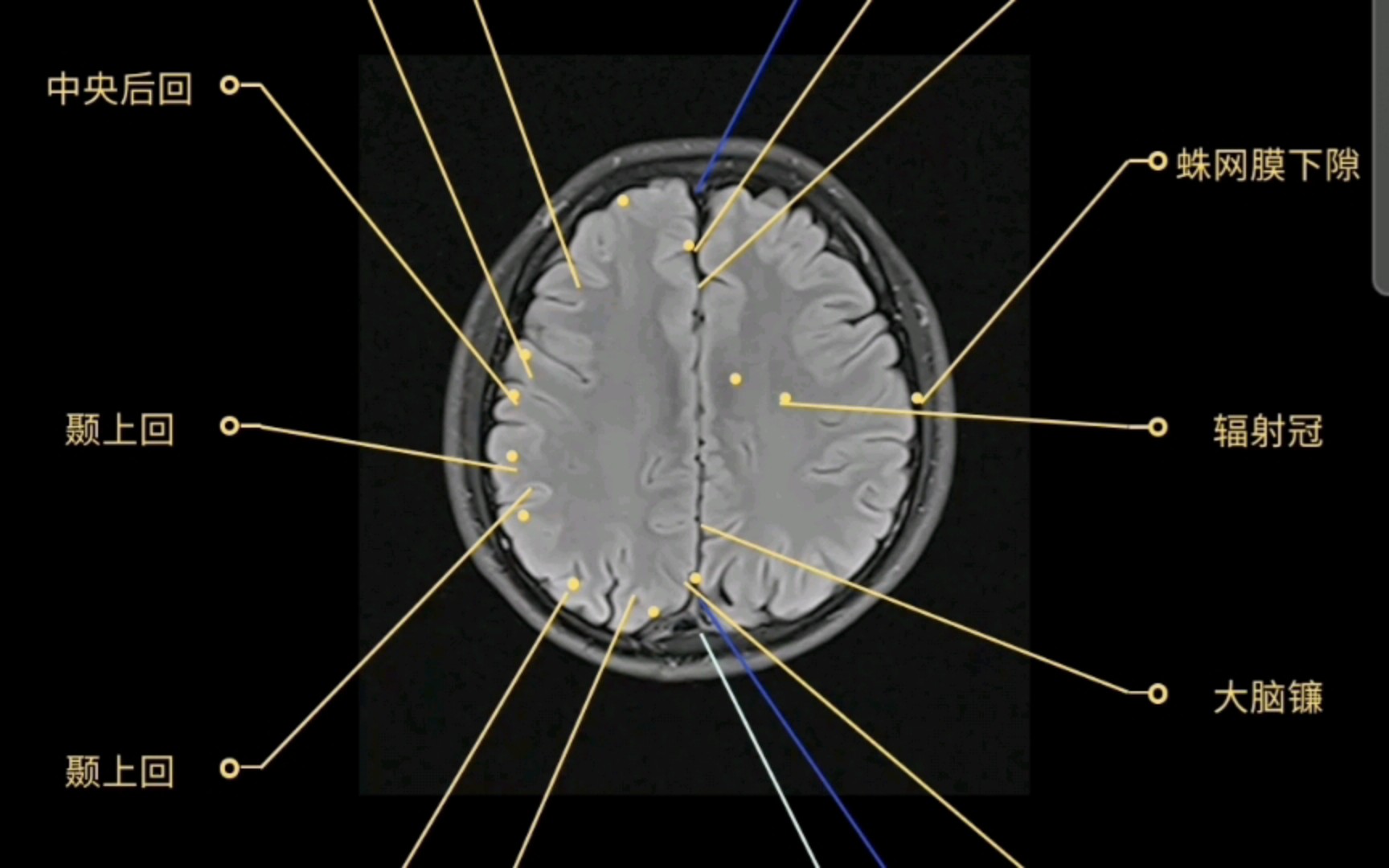 超详细脑部MRI断层分析逐帧播放‖医学生果断收藏~哔哩哔哩bilibili