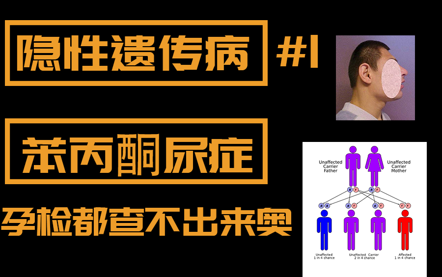 活动作品芝士分享官遗传病第一期苯丙酮尿症