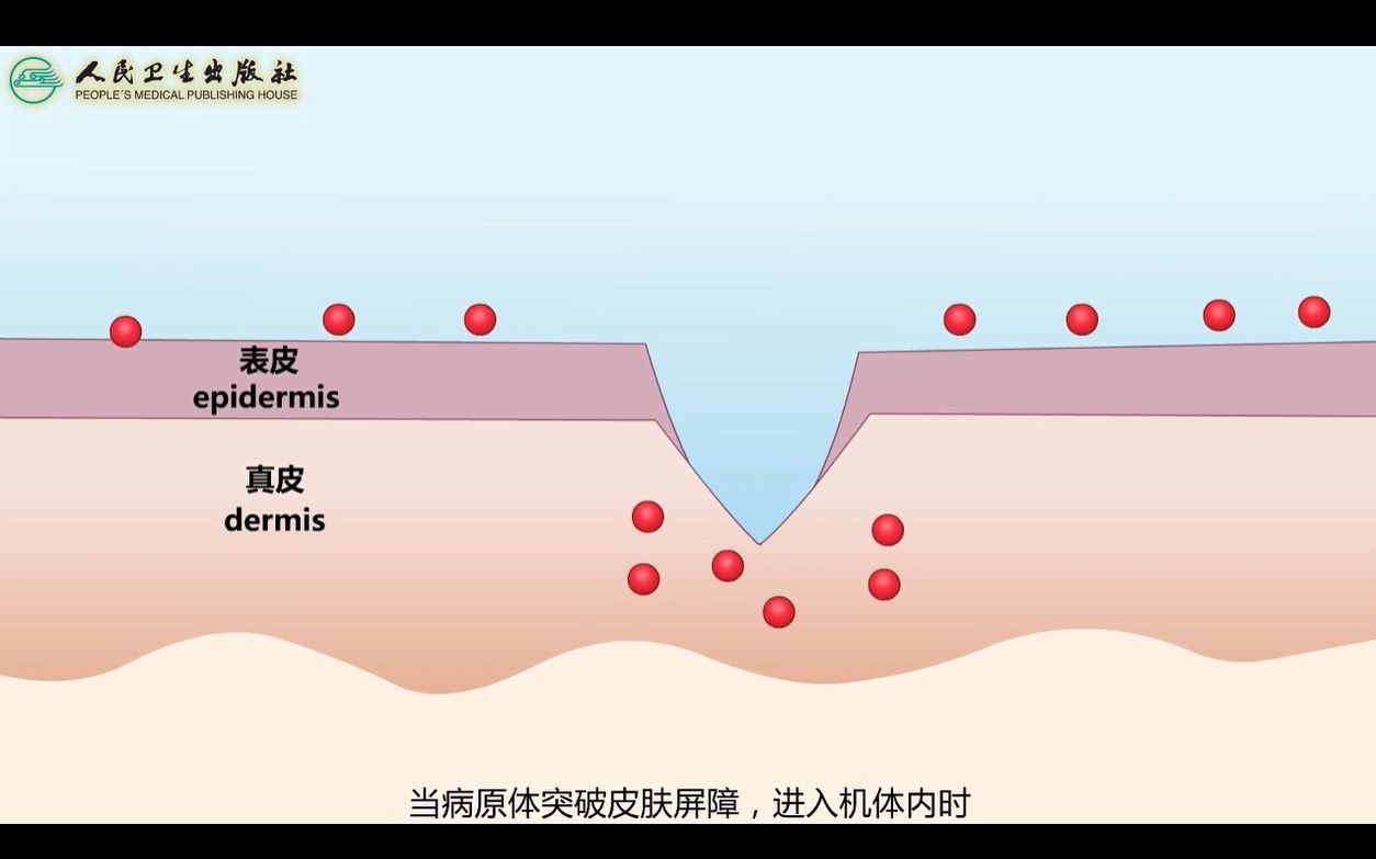 143 固有免疫应答的生物学作用哔哩哔哩bilibili