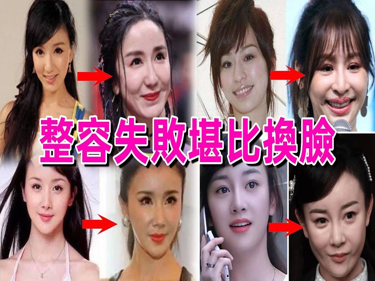 明星整容失败有多可怕,出道时貌美如花大红大紫,如今却丑到不敢照镜子