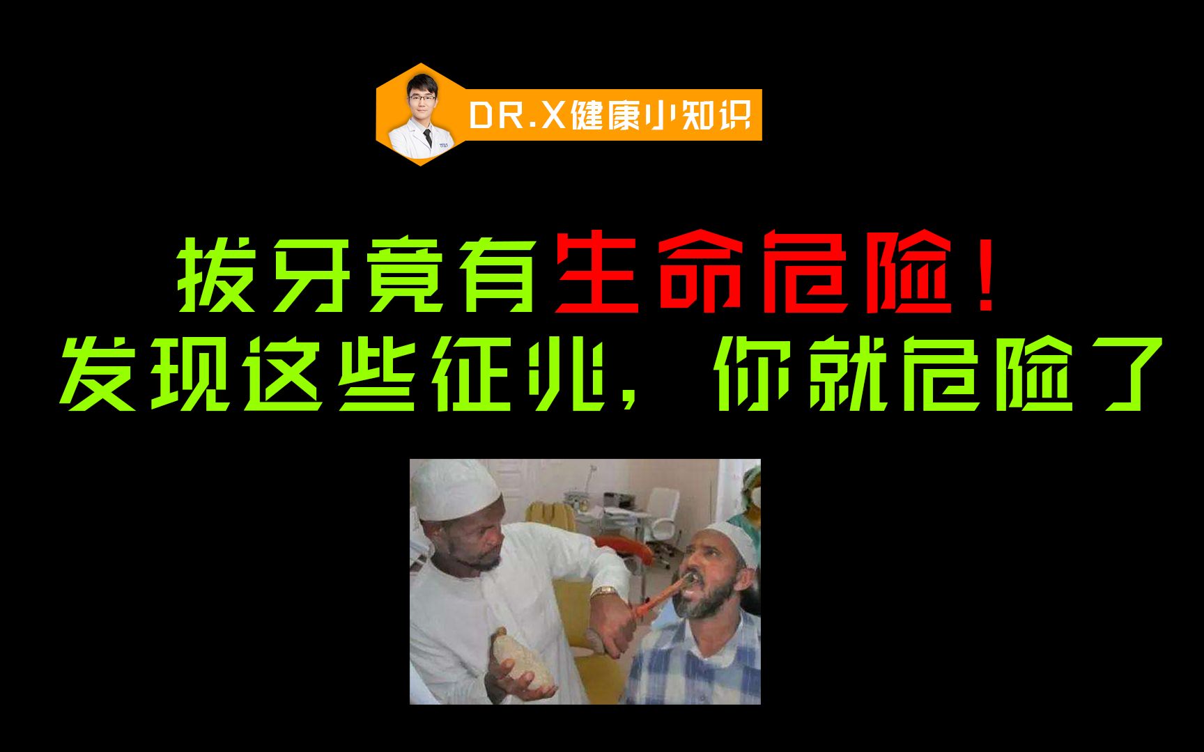 拔个牙都有生命危险!医学博士教你正确的拔牙方式.哔哩哔哩bilibili