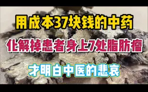 Télécharger la video: 用成本37块钱的中药，化解患者身上7处脂肪瘤，才明白中医的悲哀