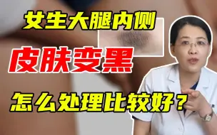 Télécharger la video: 女生大腿内侧皮肤变黑，怎么处理比较好？