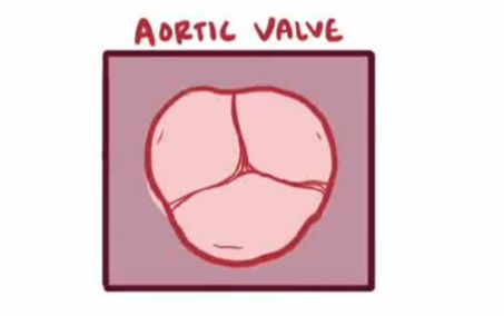 【搬运osmosis】Aortic valve disease (bicuspid, tricuspid)哔哩哔哩bilibili