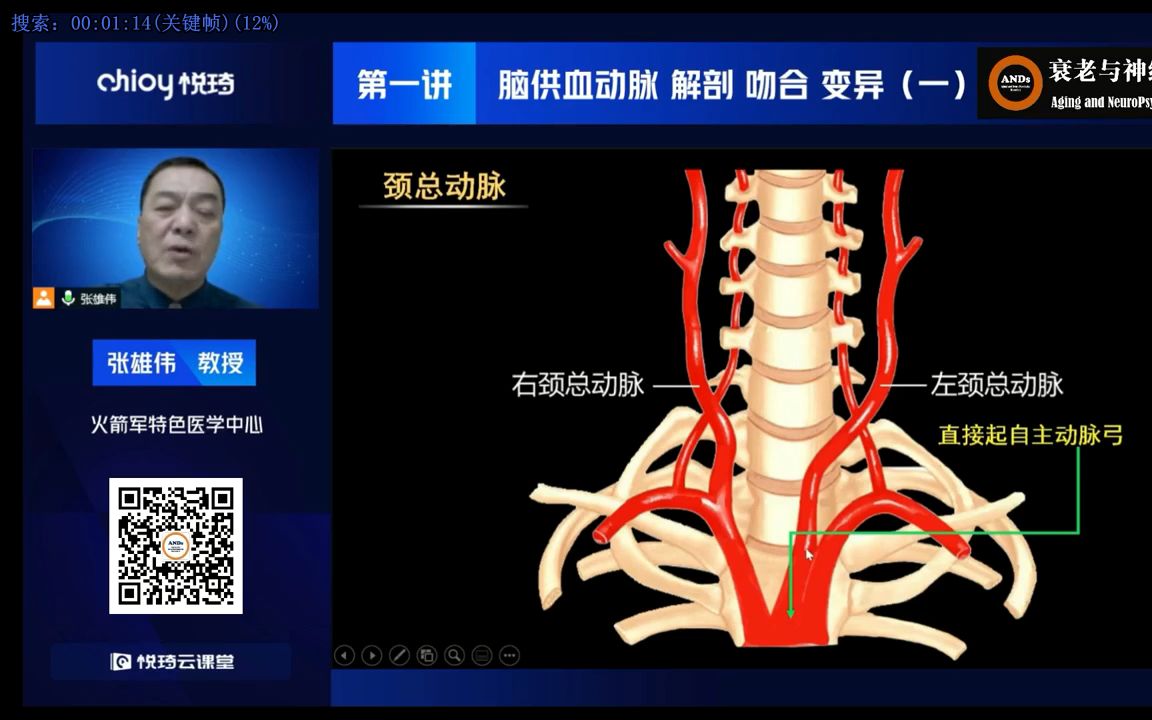 颈总动脉 解剖  吻合  变异哔哩哔哩bilibili