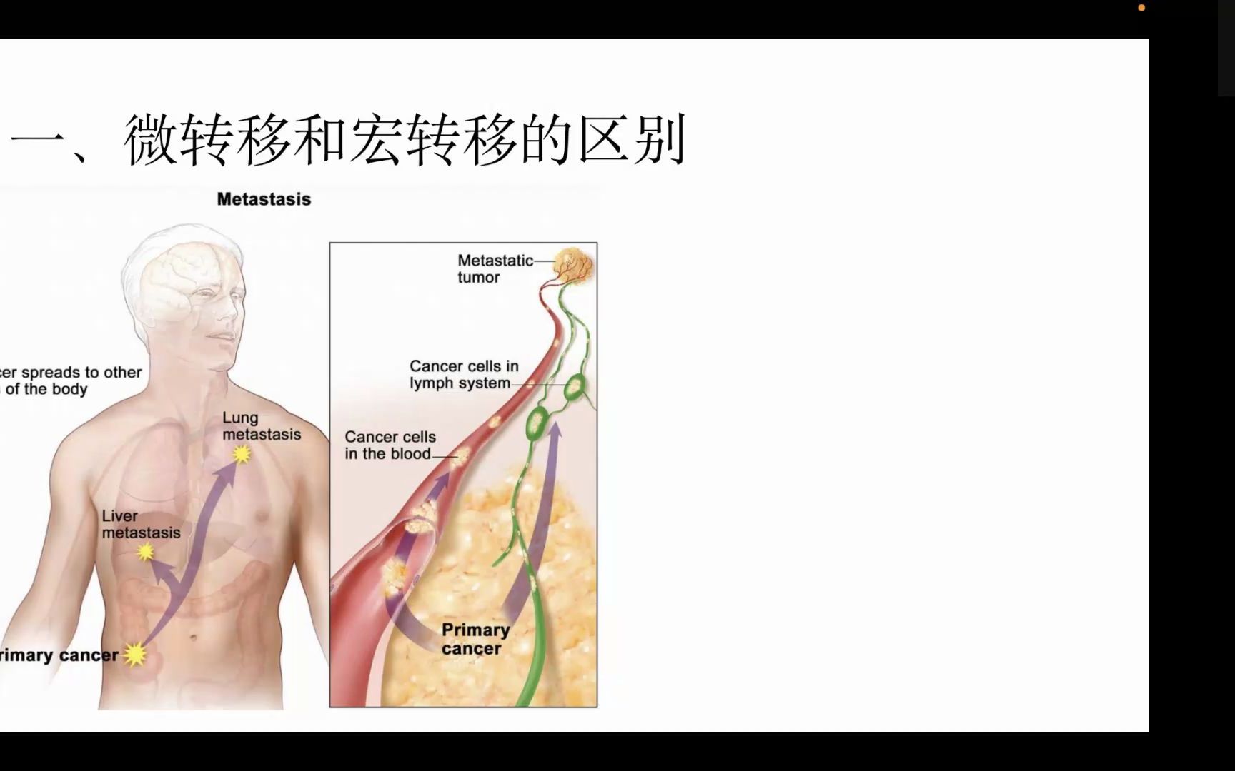 肿瘤转移相关实验方法临八2102刘彤哔哩哔哩bilibili