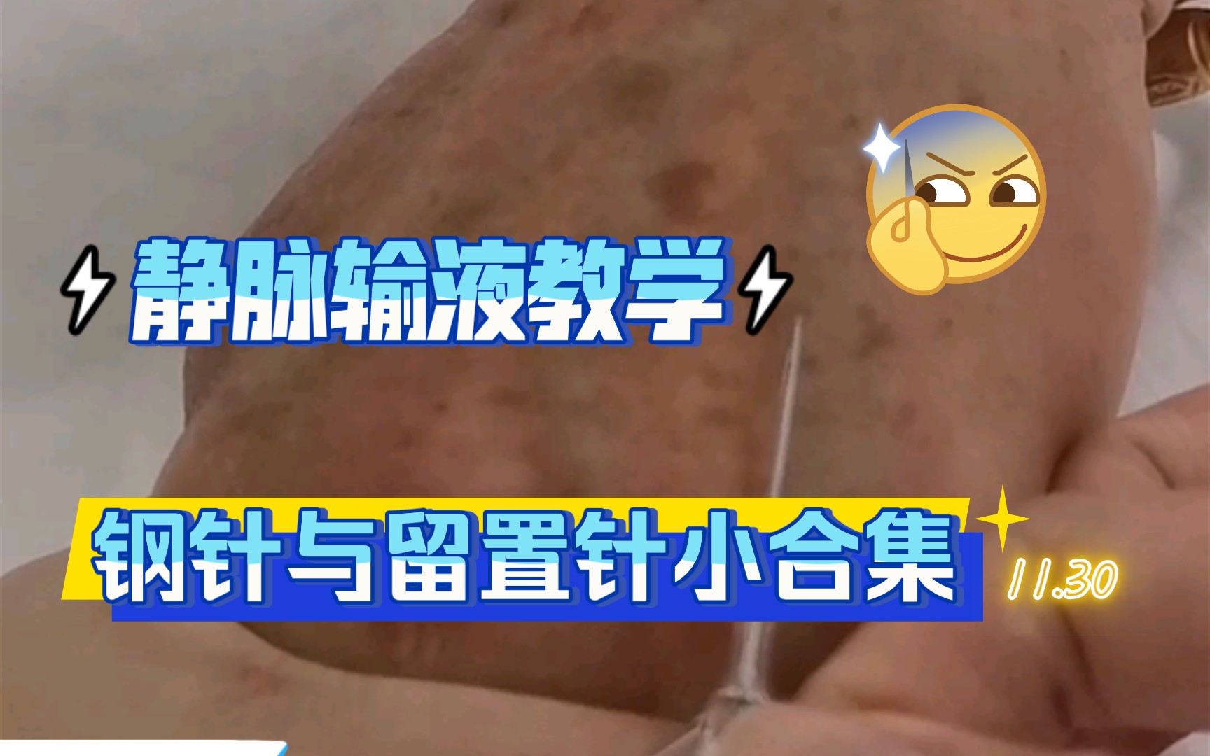 这礼拜的静脉输液作业!哔哩哔哩bilibili