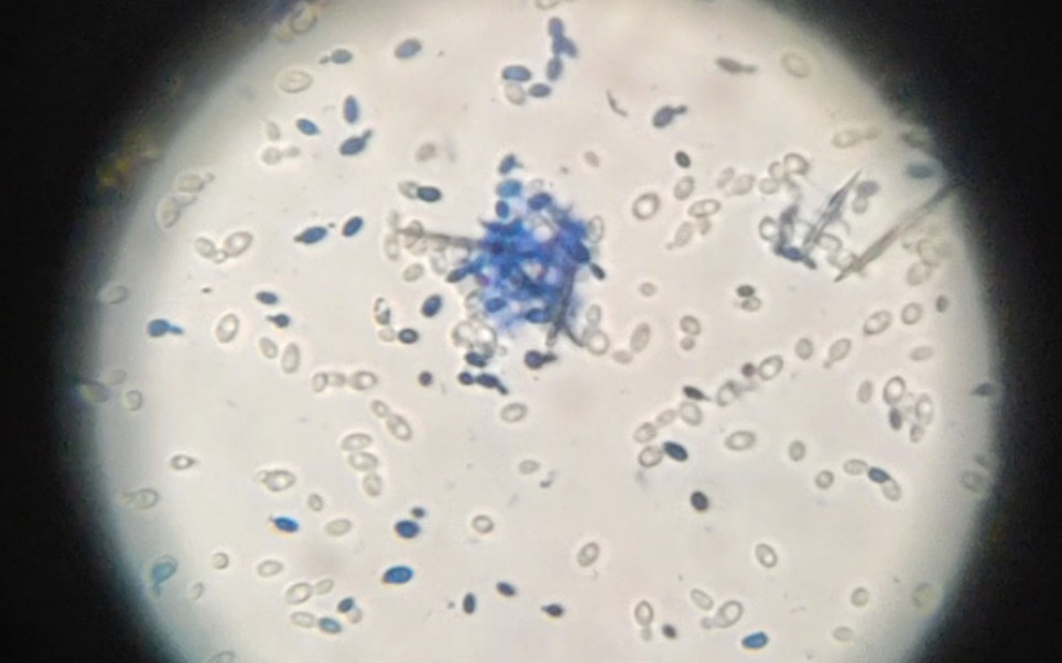 酵母菌显微镜10倍图片图片