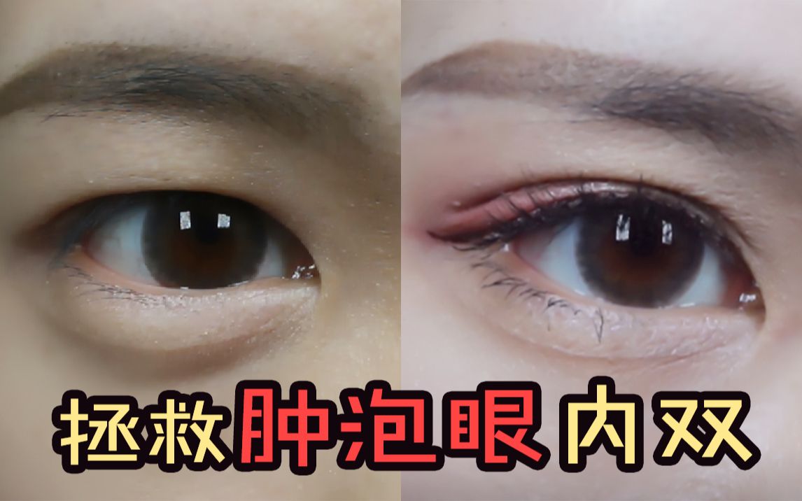 【苏小鱼】肿泡眼内双怎么贴 我是如何贴好双眼皮贴的 贴双眼皮贴