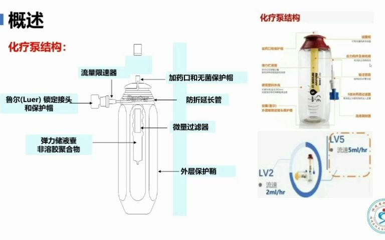 张娟—便携式化疗泵应用及护理哔哩哔哩bilibili