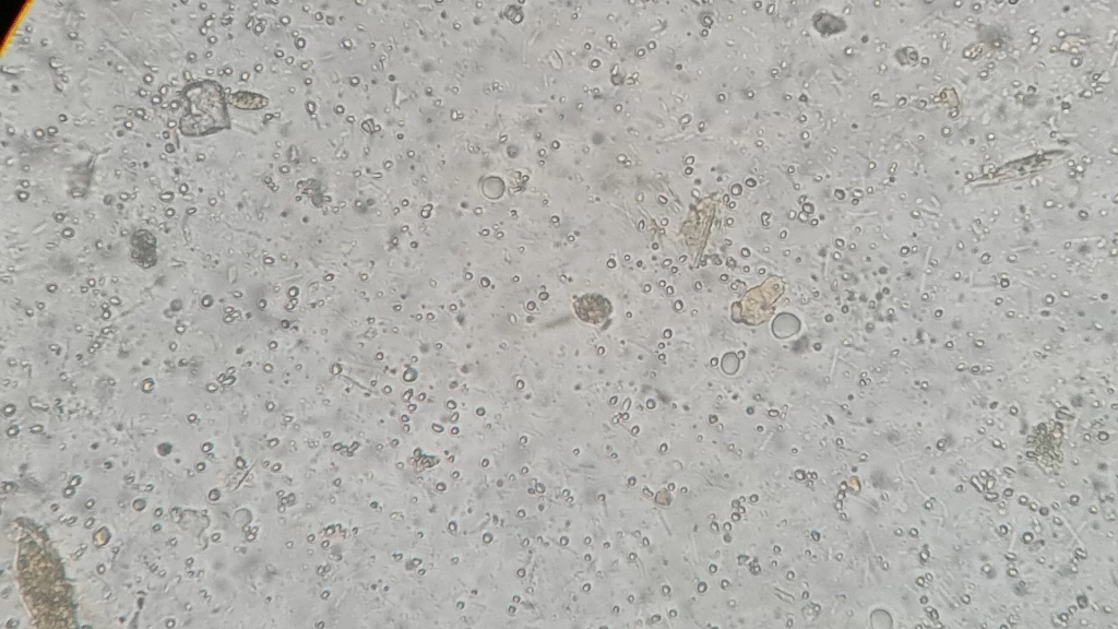 空泡型人芽囊原虫