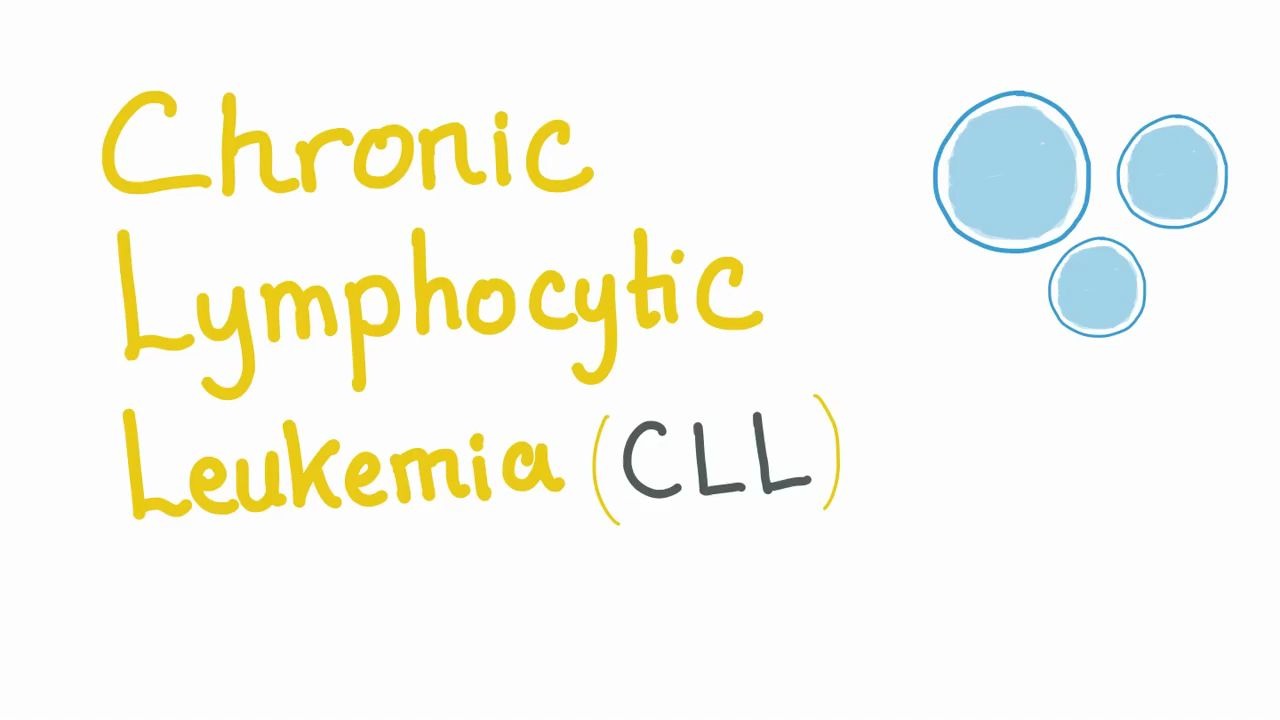 Chronic Lymphocytic Leukemia (CLL)哔哩哔哩bilibili