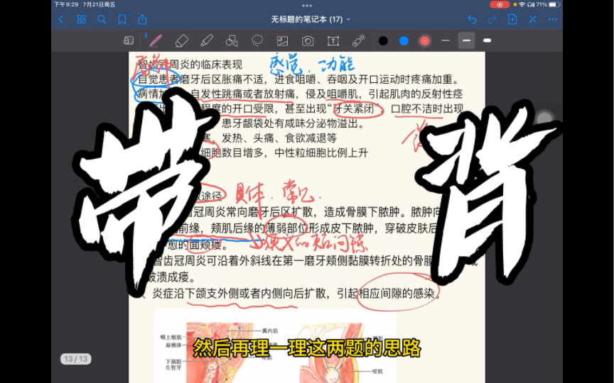 口腔颌面外科带背14智齿冠周炎|事事有回应,件件有着落哔哩哔哩bilibili