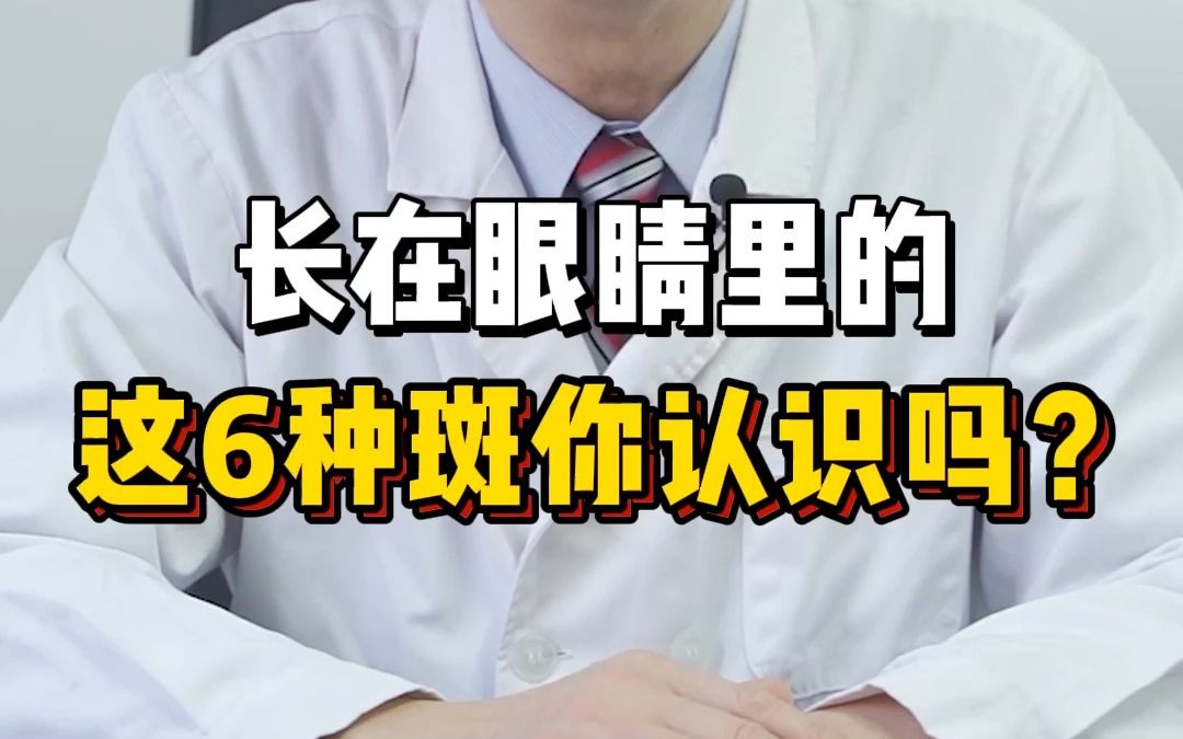 眼睛也会长斑?长在眼睛里的这6种斑你认识吗?哔哩哔哩bilibili