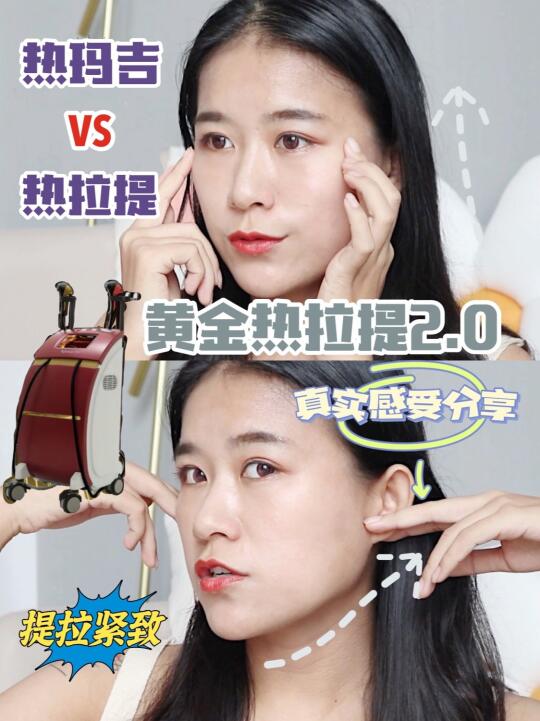 媲美热玛吉的黄金热拉提2.0,体验分享来了哔哩哔哩bilibili