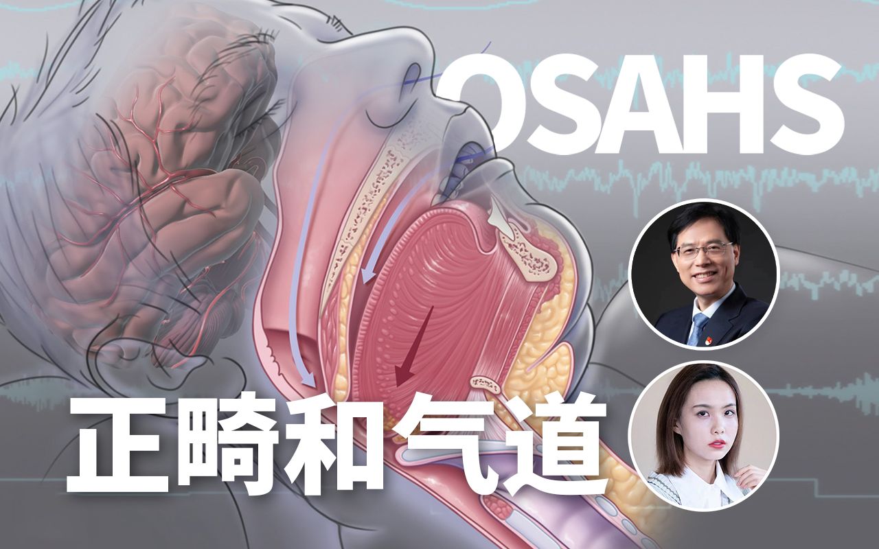 刘月华教授聊正畸与气道、OSAHS、打鼾哔哩哔哩bilibili