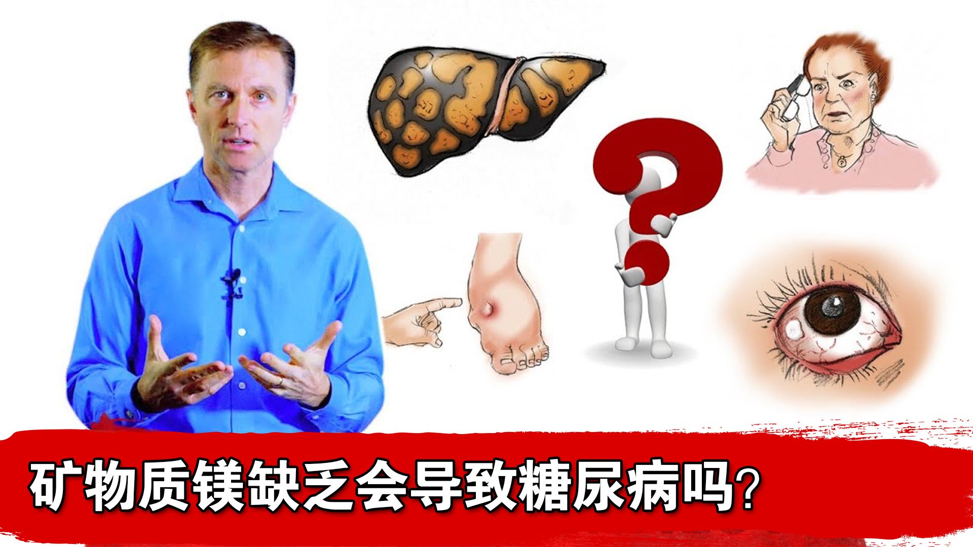 镁缺乏与糖尿病有关吗?哔哩哔哩bilibili