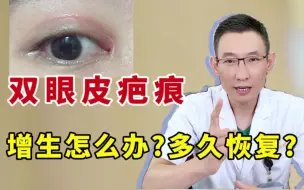 Download Video: 双眼皮术前&术后必看！想做双眼皮又担心留疤？双眼皮术后，如何判断是否进入疤痕增生期？双眼皮疤痕增生如何恢复更快？