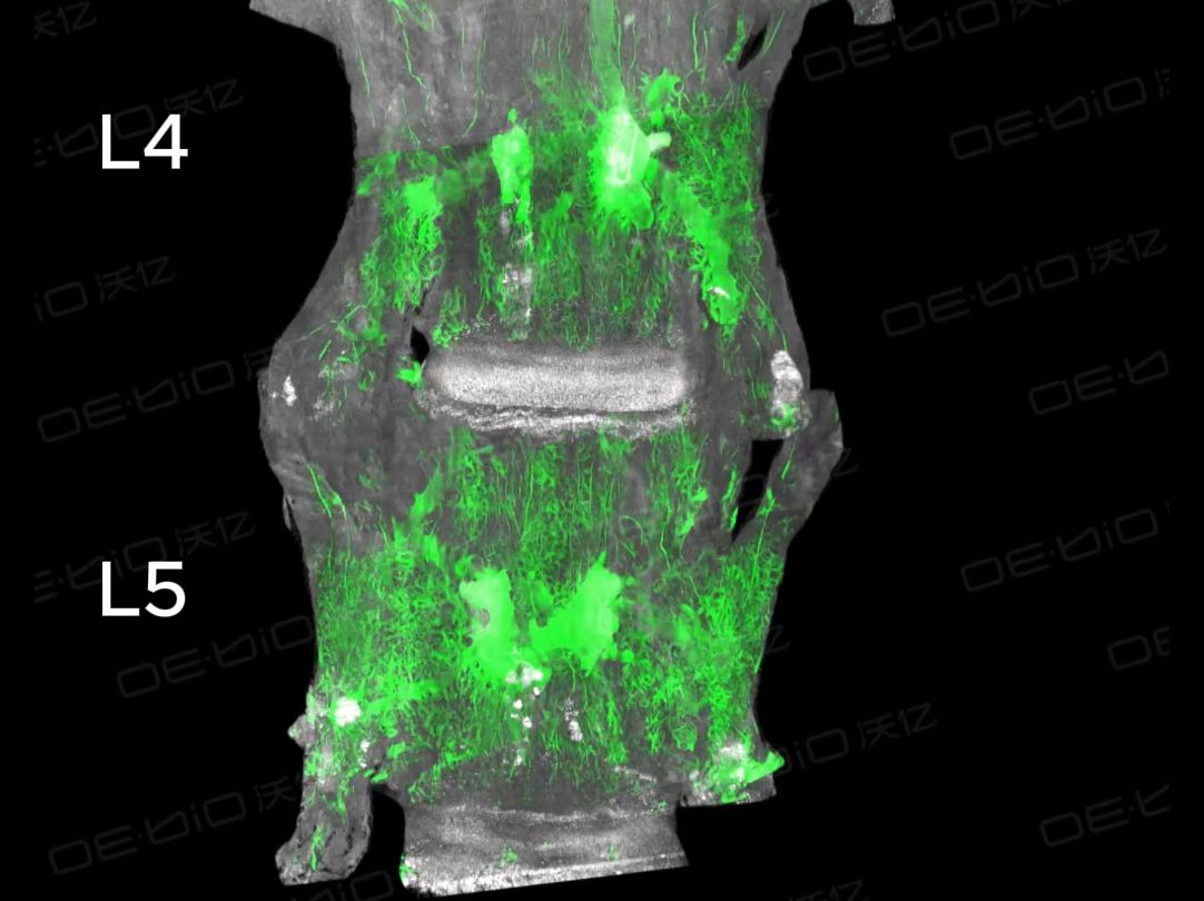 c57小鼠腰椎血管和细胞构筑三维成像哔哩哔哩bilibili