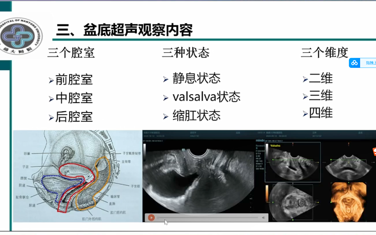 盆底超声的基础临床应用倪雪君哔哩哔哩bilibili