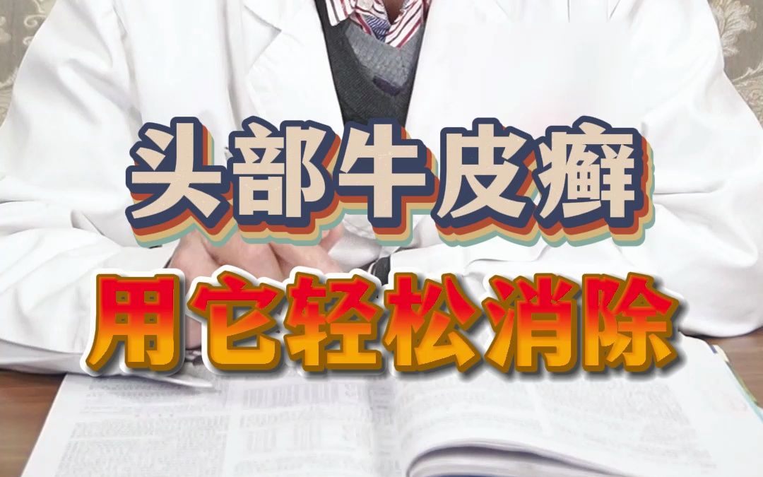 头部牛皮癣用它轻松消除.哔哩哔哩bilibili