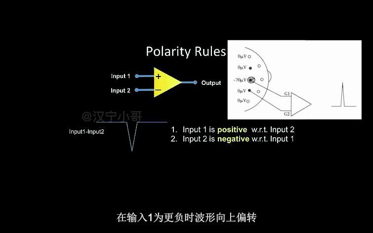 06.脑电图0基础  揭开脑电图的极性规则的奥秘哔哩哔哩bilibili