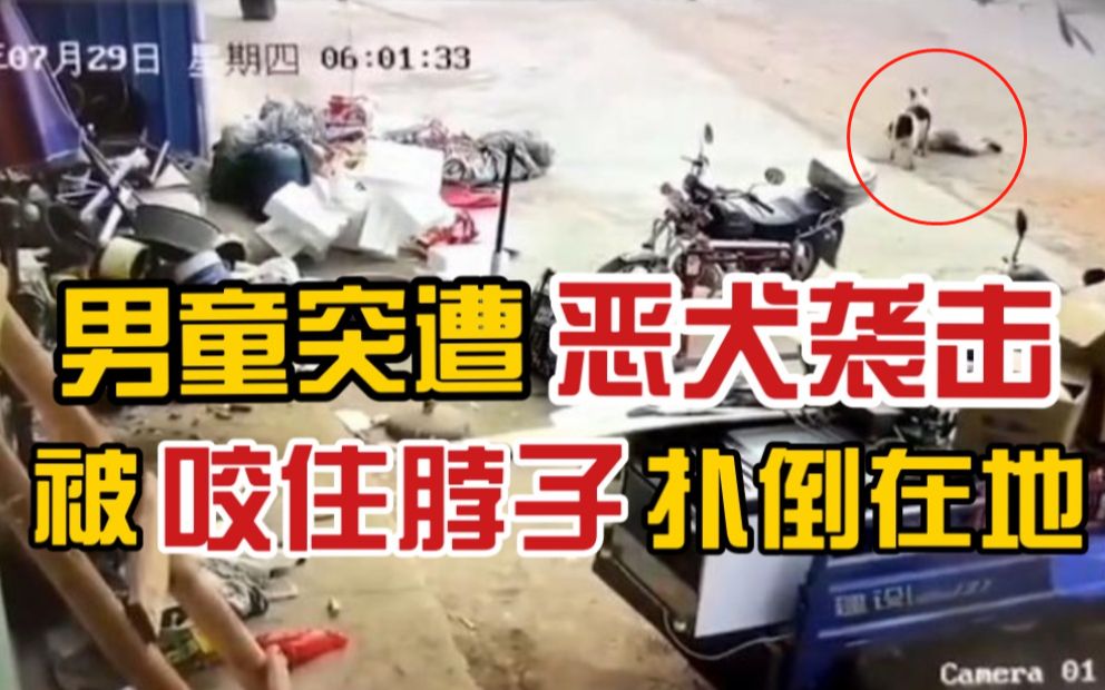 [图]吓人！男童突遭恶犬袭击咬住脖子，附近居民找到恶犬将其打死