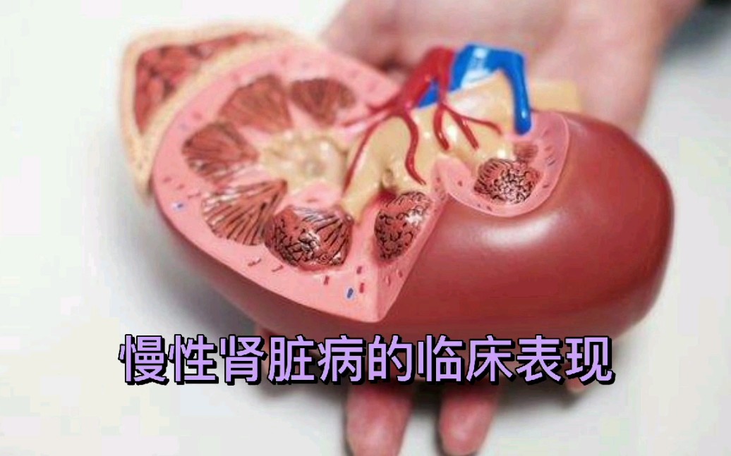 [图]慢性肾脏病为何被称为“隐形杀手”，看看它的临床表现就明白了！