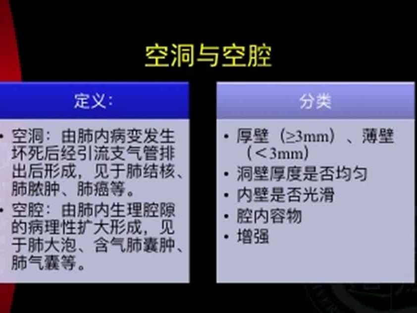 肺部影像学基本概念及影像学鉴别——空洞(坏死)哔哩哔哩bilibili