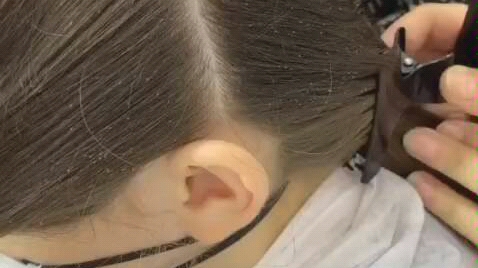 密集恐惧症女孩的头发都是跳蚤最后用机器把跳蚤都吸出来