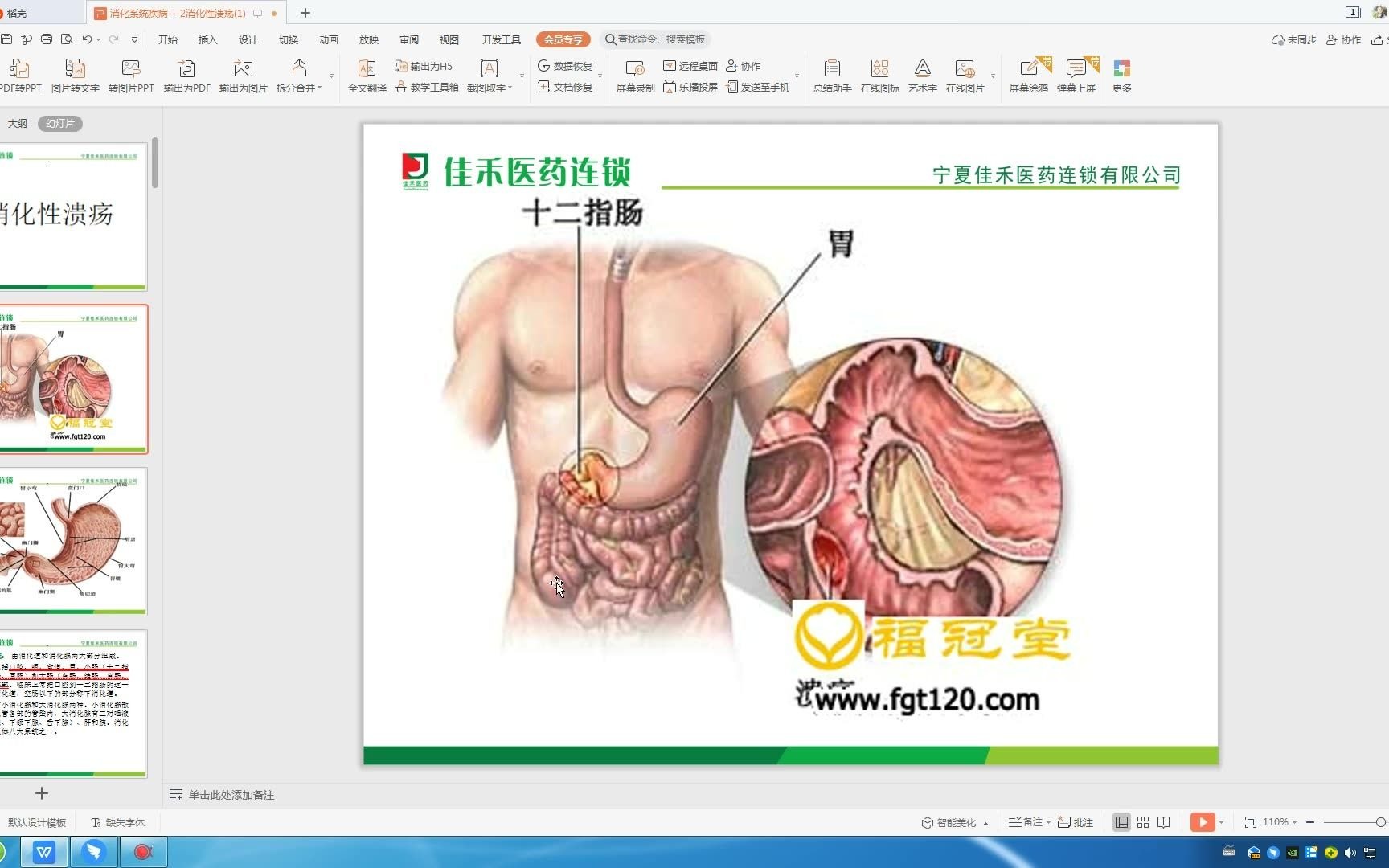 [图]消化性溃疡（视频课）