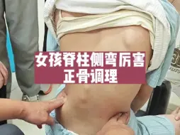 Download Video: 女孩脊柱侧弯，cobb角35-40度！正骨调理！学习正骨找仲崇斌教授