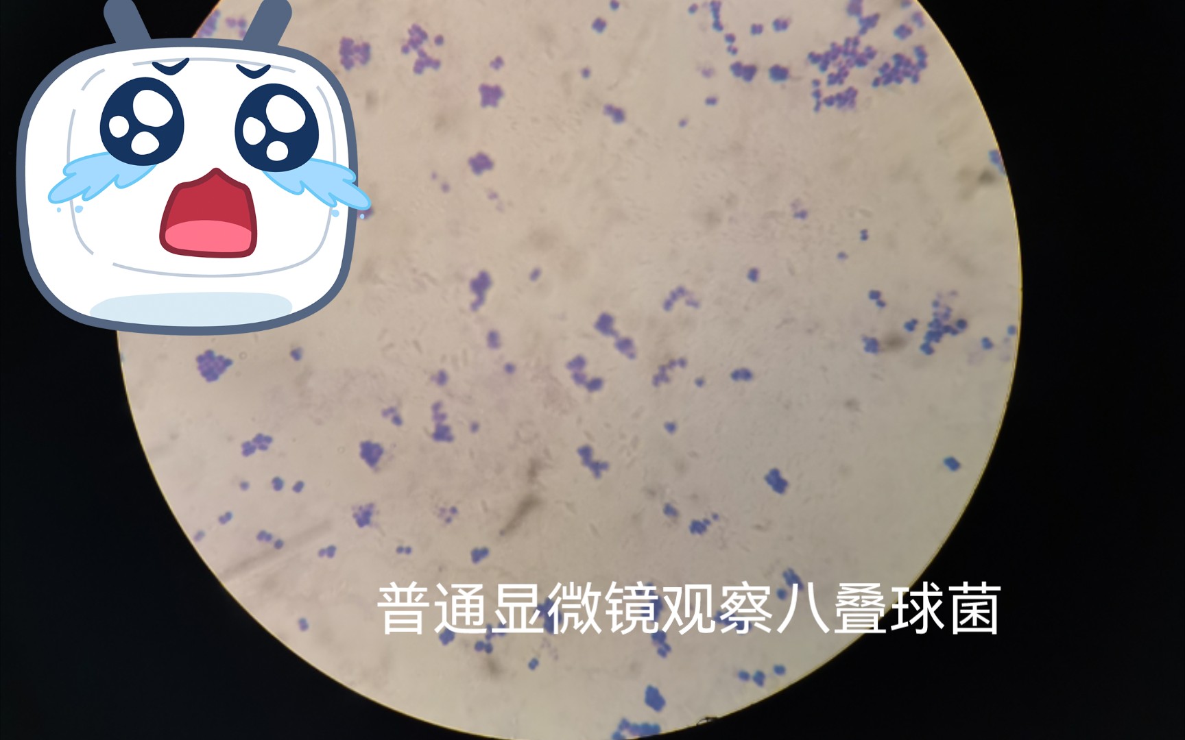 普通显微镜下的八叠球菌(现成涂片观察)哔哩哔哩bilibili