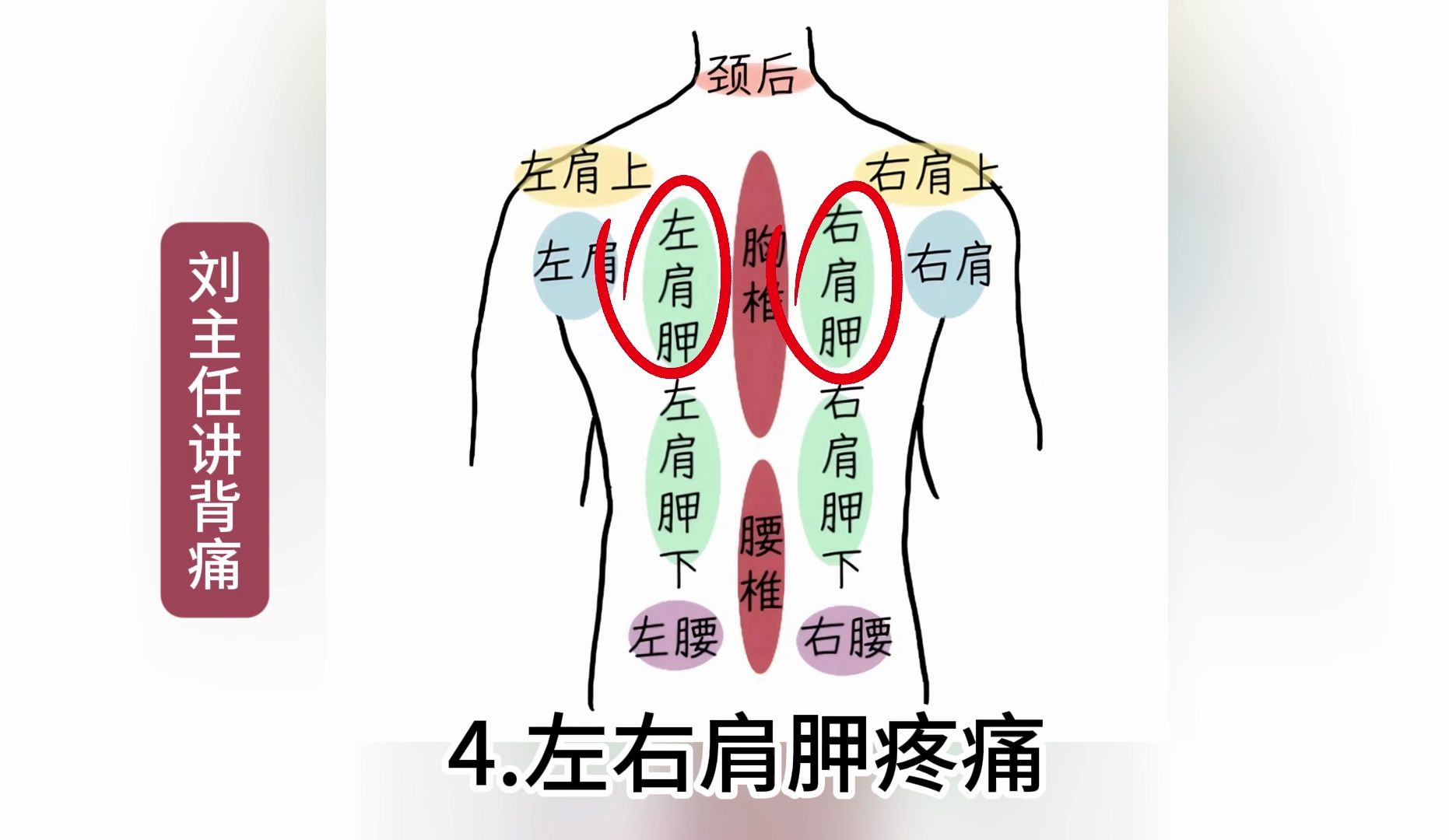 腰痛的七种位置图图片