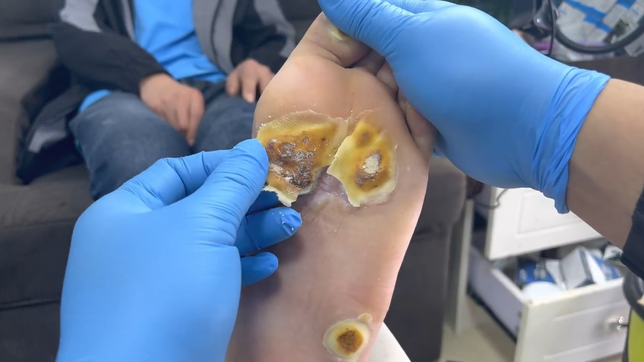 这脚还要吗砍了吧